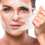 Peeling